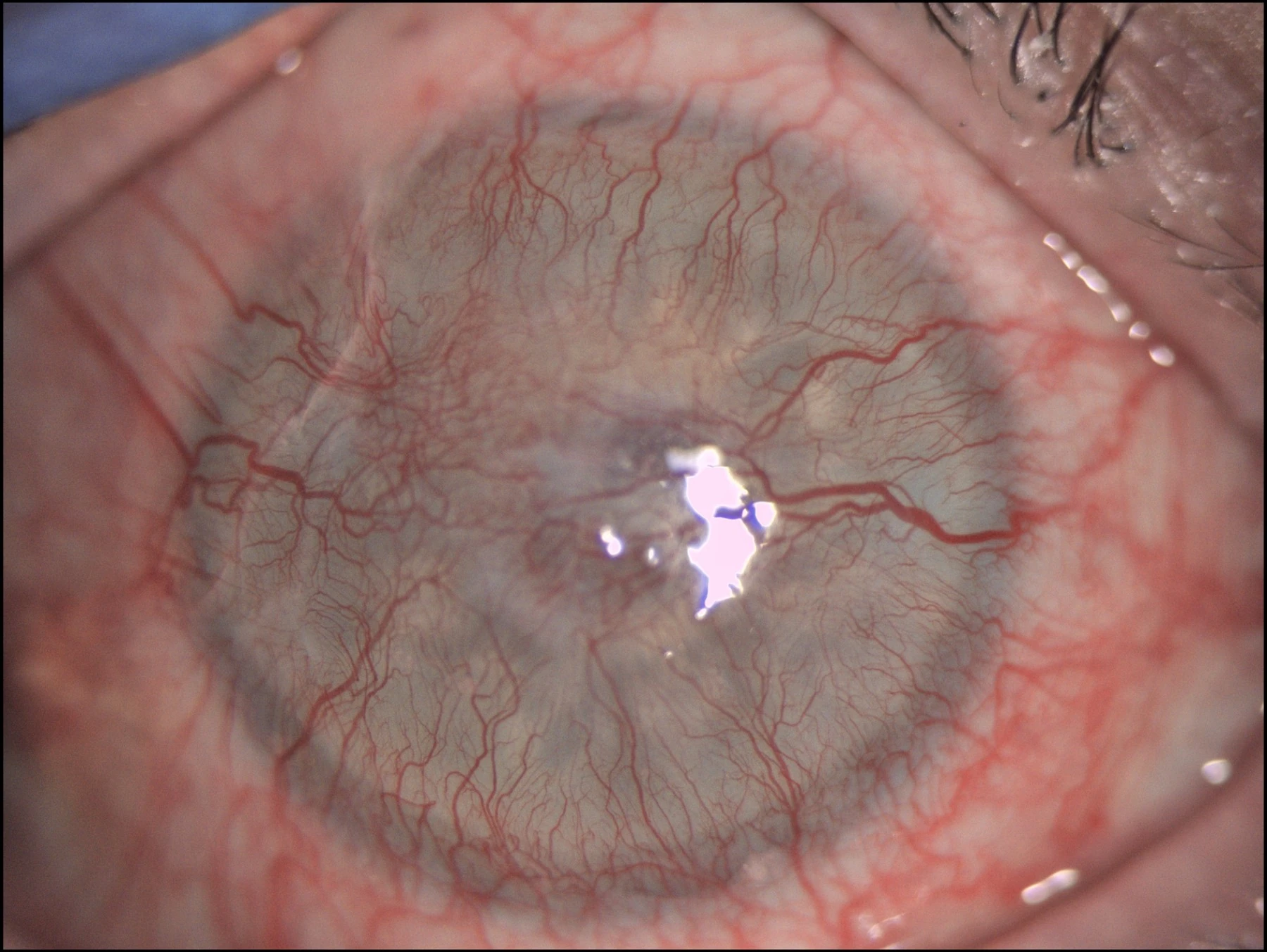Clinical image for keratoprosthesis evaluation