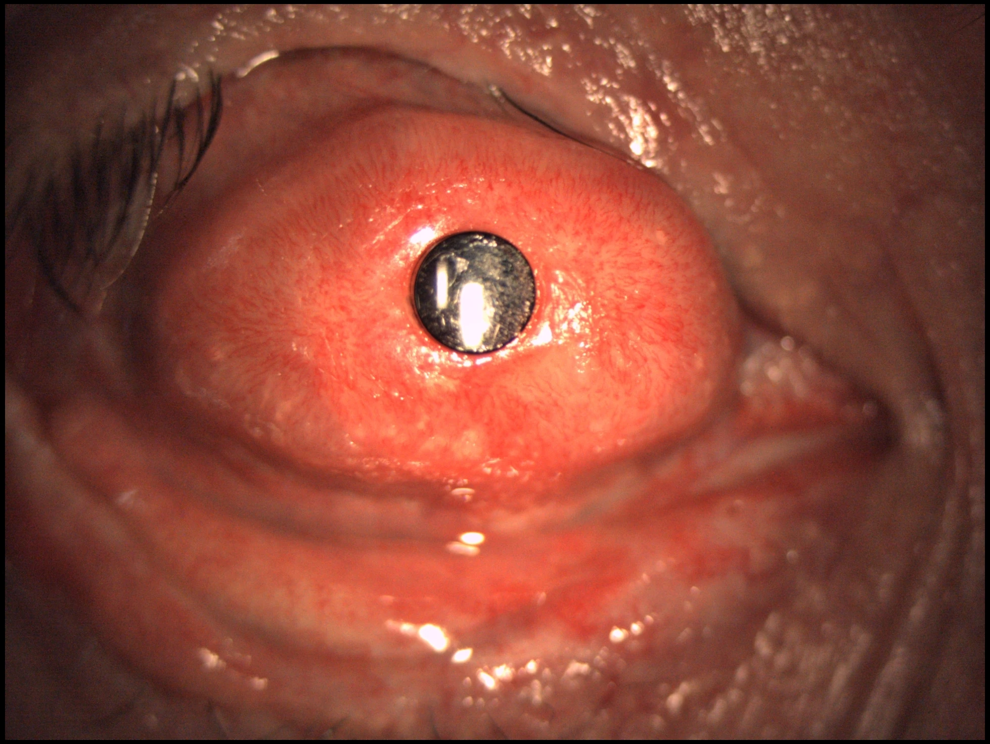 OOKP frontal clinical image