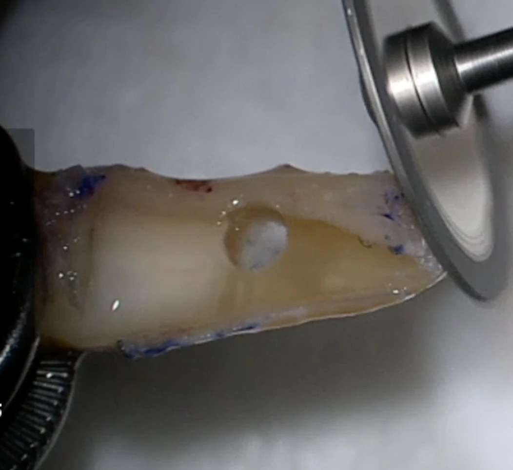 OOKP · Lamina polishing